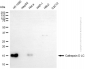 KD-Validated Anti-Cathepsin D LC Rabbit Polyclonal Antibody
