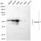 KD-Validated Anti-KeRatin 7 Rabbit Polyclonal Antibody