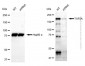 KD-Validated Anti-TOP2A Rabbit Polyclonal Antibody