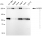 KD-Validated Anti-ACACA Rabbit Polyclonal Antibody