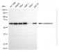 KD-Validated Anti-CDK5RAP3 Rabbit Monoclonal Antibody