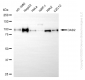 KD-Validated Anti-DAB2 Rabbit Monoclonal Antibody