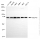 KD-Validated Anti-NDUFS1 Rabbit Monoclonal Antibody