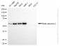 KD-Validated Anti-Malic Enzyme 2 Rabbit Monoclonal Antibody