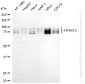 KD-Validated Anti-PIP5K1C Rabbit Monoclonal Antibody