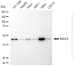 KD-Validated Anti-NR2F2 Rabbit Monoclonal Antibody