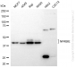 KD-Validated Anti-NFKBIE Rabbit Monoclonal Antibody