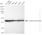 KD-Validated Anti-alpha smooth muscle Actin Rabbit Monoclonal Antibody