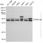 KD-Validated Anti-GSK3 alpha/beta Rabbit Monoclonal Antibody