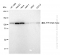 KD-Validated Anti-ATP citrate lyase Rabbit Monoclonal Antibody