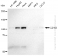 KD-Validated Anti-CD163 Rabbit Monoclonal Antibody