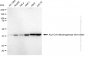 KD-Validated Anti-Acyl-CoA dehydrogenase short chain Rabbit Monoclonal Antibody