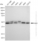 KD-Validated Anti-Arp3 Rabbit Monoclonal Antibody