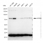 KD-Validated Anti-ACSS2 Rabbit Monoclonal Antibody