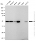 KD-Validated Anti-ADK Rabbit Monoclonal Antibody