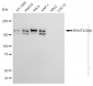 KD-Validated Anti-EHMT2/G9A Rabbit Monoclonal Antibody