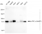KD-Validated Anti-Phospho-PKC alpha (Ser657) Rabbit Monoclonal Antibody