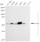 KD-Validated Anti-Smad2 Rabbit Monoclonal Antibody