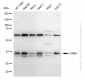 KD-Validated Anti-CRKII Rabbit Monoclonal Antibody