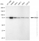 KD-Validated Anti-RRM1 Rabbit Monoclonal Antibody