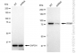 KD-Validated Anti-RRM1 Rabbit Monoclonal Antibody