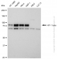 KD-Validated Anti-HIF 1 β Rabbit Monoclonal Antibody