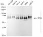 KD-Validated Anti-TFE3 Rabbit Monoclonal Antibody