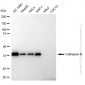 KD-Validated Anti-Cathepsin B Rabbit Monoclonal Antibody
