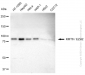 KD-Validated Anti-KMT6/EZH2 Rabbit Monoclonal Antibody