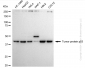 KO-Validated Anti-Tumor Protein P53 Rabbit Polyclonal Antibody