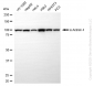 KO Validated Anti-Actinin Alpha 4 Rabbit Monoclonal Antibody