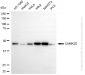 KO Validated Anti-CAMK2D Rabbit Monoclonal Antibody
