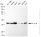 KO Validated Anti-ACADM Rabbit Monoclonal Antibody