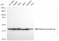 KO-Validated Anti-Ribosomal Protein SA Rabbit Monoclonal Antibody