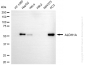 KO-Validated Anti-ALDH1A3 Mouse Monoclonal Antibody
