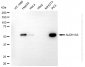 KO-Validated Anti-ALDH1A3 Mouse Monoclonal Antibody