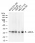 LDHA Recombinant Rabbit mAb