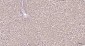 LDHA Recombinant Rabbit mAb