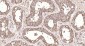 LDHA Recombinant Rabbit mAb