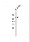AKT3(S472) Antibody